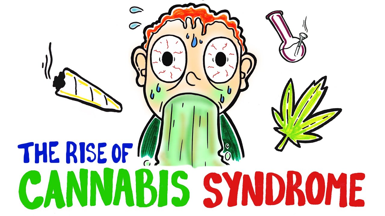 A kanabisz szindróma