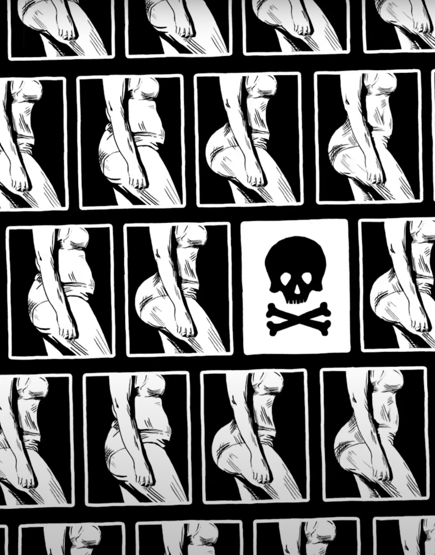 Miért olyan veszélyes a brazil fenékfelvarrás